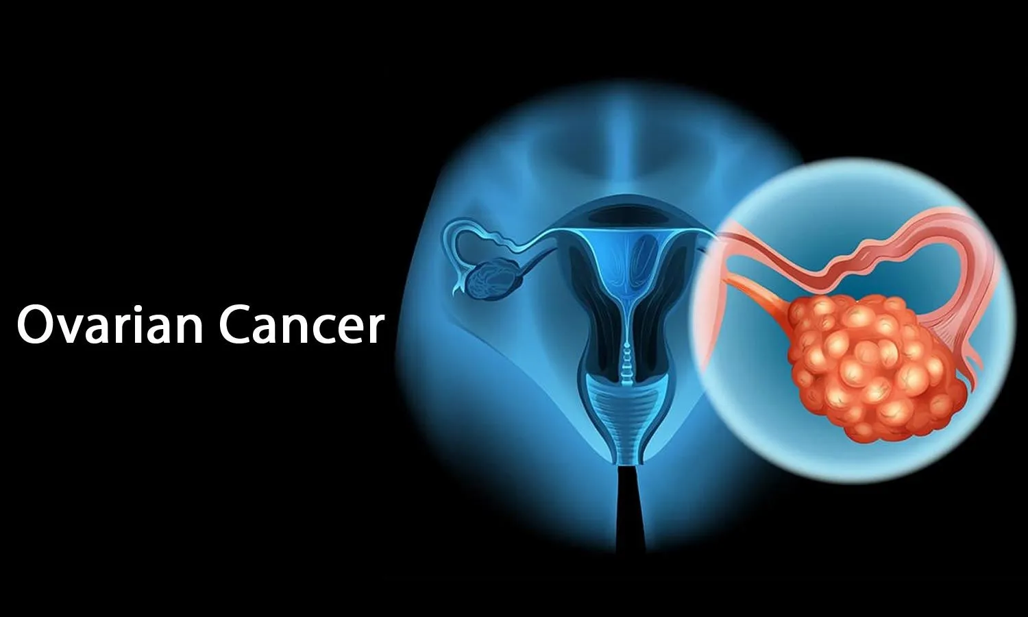 This Doctor's Diet Advice Could Help Women Lower Ovarian Cancer Risk—And It's Backed by New Research